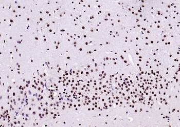 Beclin 1 Mouse Monoclonal Antibody