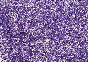Beclin 1 Mouse Monoclonal Antibody