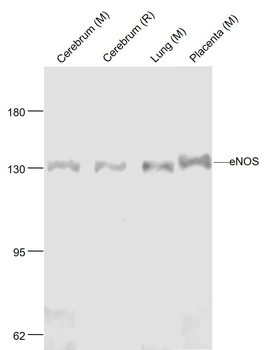 ENOS Mouse Monoclonal Antibody