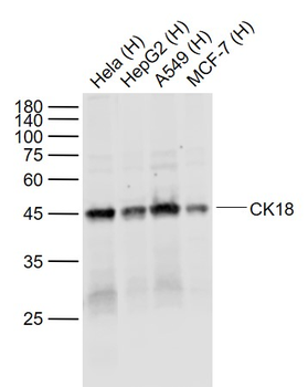 CK18 Mouse Monoclonal Antibody