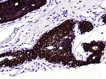 CK18 Mouse Monoclonal Antibody