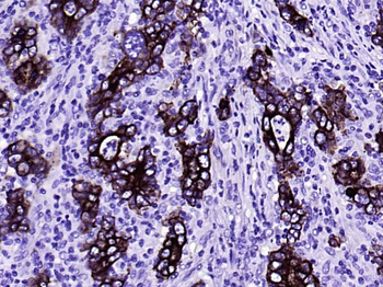 CK18 Mouse Monoclonal Antibody