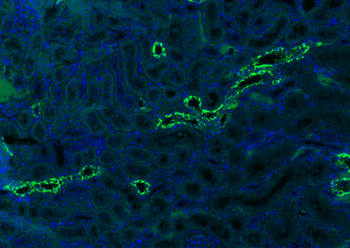 CK18 Mouse Monoclonal Antibody