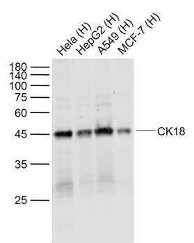 CK18 antibody