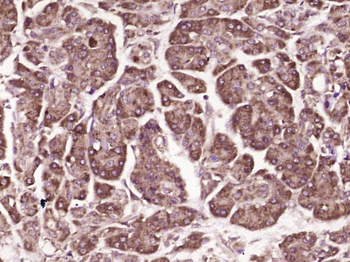 RNF128 Rabbit Polyclonal Antibody