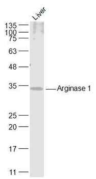 Arginase 1 Rabbit Polyclonal Antibody