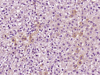 C5b-9 Rabbit Polyclonal Antibody