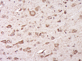 AGO2 Rabbit Polyclonal Antibody
