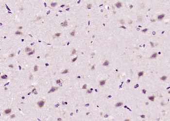 GLRB Rabbit Polyclonal Antibody