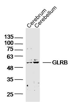 GLRB Rabbit Polyclonal Antibody