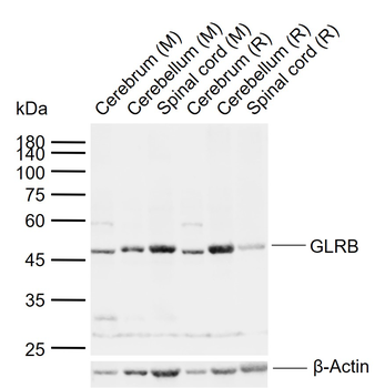 GLRB Rabbit Polyclonal Antibody