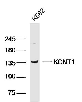 KCNT1 Rabbit Polyclonal Antibody