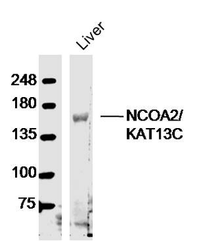 NCOA2/KAT13C Rabbit Polyclonal Antibody