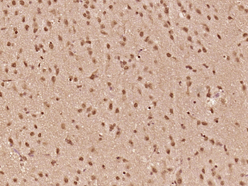 RGS20 Rabbit Polyclonal Antibody