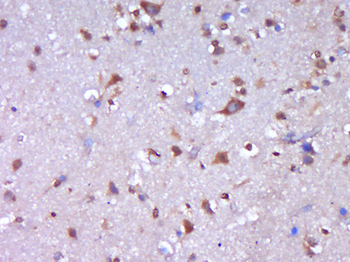 C1orf173 Rabbit Polyclonal Antibody