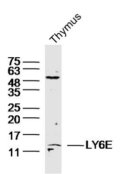 LY6E Rabbit Polyclonal Antibody