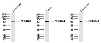 NHEDC1 Rabbit Polyclonal Antibody