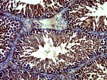 DUSP21 Rabbit Polyclonal Antibody