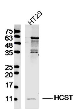 HCST Rabbit Polyclonal Antibody