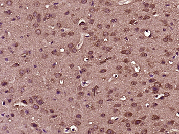 CD63 Rabbit Polyclonal Antibody