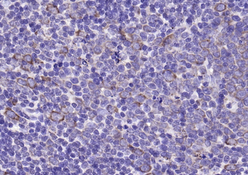 CD63 Rabbit Polyclonal Antibody