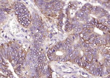 CA9 Mouse Monoclonal Antibody