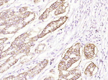 CA9 Mouse Monoclonal Antibody
