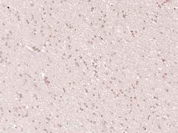Cleaved PARP1 Mouse Monoclonal Antibody