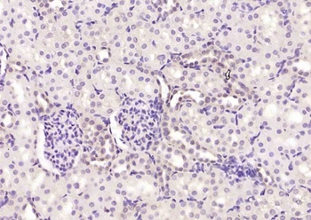 Bcl-2 antibody