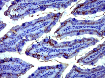 NF kB P65 (Acetyl-Lys314/Lys315) Mouse Monoclonal Antibody