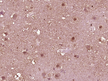STAT1 Mouse Monoclonal Antibody