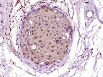 STAT1 Mouse Monoclonal Antibody