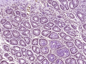 STAT1 Mouse Monoclonal Antibody