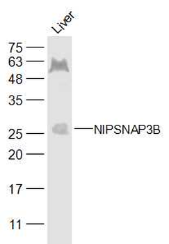 NIPSNAP3B Rabbit Polyclonal Antibody