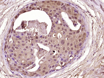 Caspase-2 p18 Rabbit Polyclonal Antibody