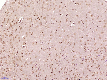 Caspase-2 p18 Rabbit Polyclonal Antibody