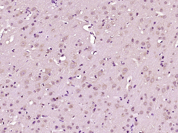 Caspase-2 p18 Rabbit Polyclonal Antibody