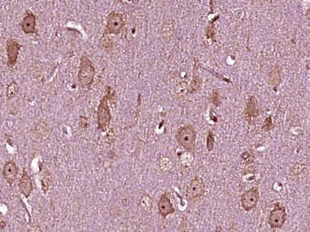 Asparagine Synthetase antibody