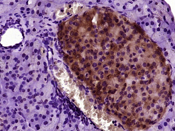 Marapsin1/CAPH2 Rabbit Polyclonal Antibody