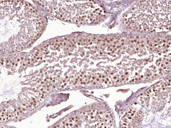 SGOL2 Rabbit Polyclonal Antibody