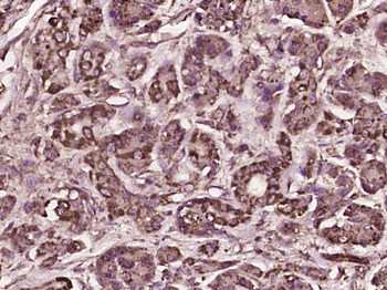 IL28A Rabbit Polyclonal Antibody