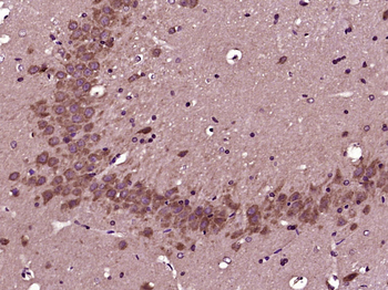 RBM33 Rabbit Polyclonal Antibody