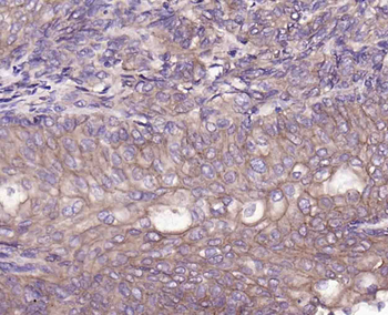 ABCB5 Mouse Monoclonal Antibody