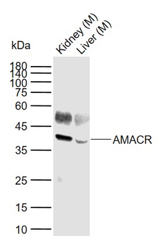 AMACR Mouse Monoclonal Antibody