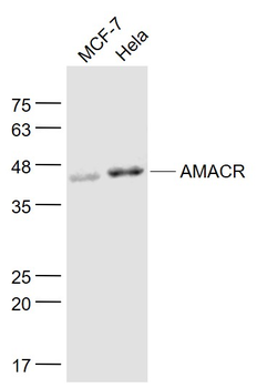 AMACR Mouse Monoclonal Antibody