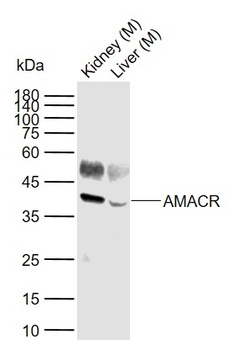 AMACR antibody