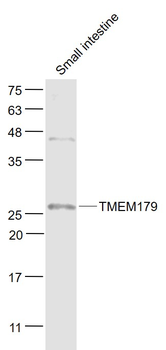 TMEM179 Rabbit Polyclonal Antibody