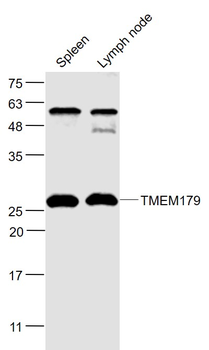 TMEM179 Rabbit Polyclonal Antibody