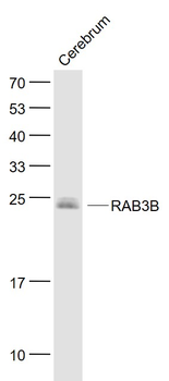 RAB3B Mouse Monoclonal Antibody