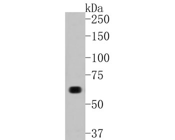 COL10A1 Recombinant Rabbit Monoclonal Antibody